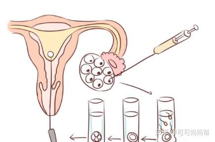 女同伴侣借卵代怀生殖医学中心